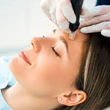 Proximity to Beauty: Microneedling Services in Your Vicinity