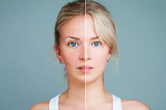 Your Path to Plumpness: Collagen Injections Close By